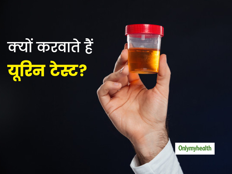 क्या होता है यूरिन टेस्ट? क्यों किया जाता है ये टेस्ट? यहां जानें पूरी जानकारी